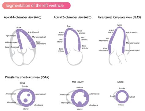 echocardiography wall motion abnormalities.